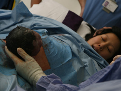 Γονιμότητα: Τακτικές ελάττωσης του αριθμού των καισαρικών τομών